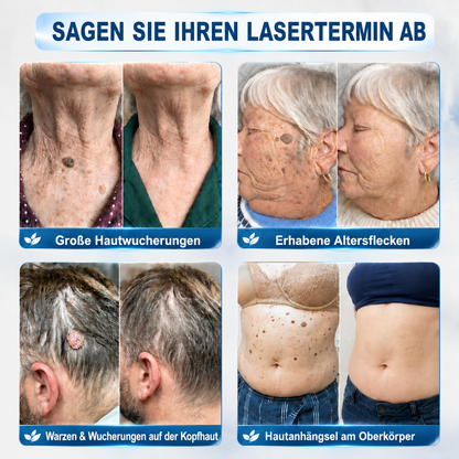 🎁 Nur noch 5 Kisten von 𝐈𝐧𝐬𝐋𝐞𝐦𝐨𝐧®  übrig! Heute zusätzlich 30 % sparen – Fühlen Sie sich jeden Tag besser, bevor dieses zeitlich begrenzte Angebot endet!