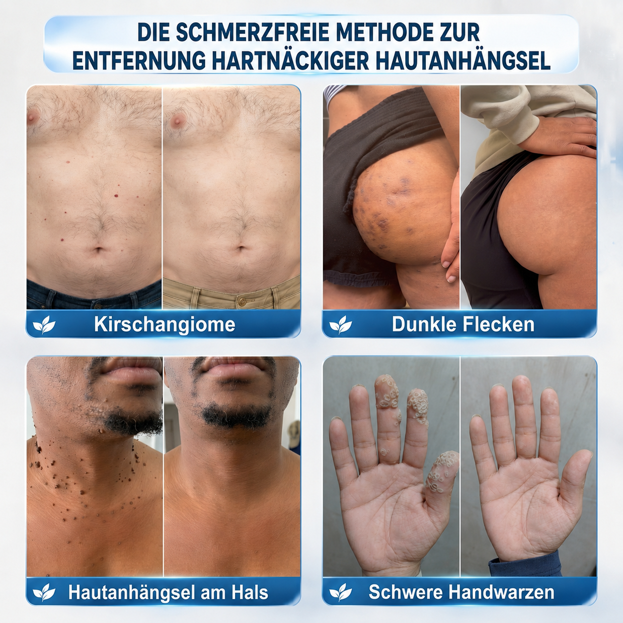 🎁 Nur noch 5 Kisten von 𝐈𝐧𝐬𝐋𝐞𝐦𝐨𝐧®  übrig! Heute zusätzlich 30 % sparen – Fühlen Sie sich jeden Tag besser, bevor dieses zeitlich begrenzte Angebot endet!