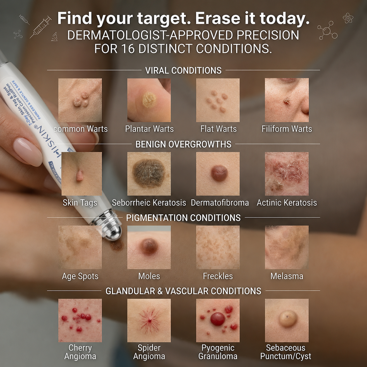 HISKIN®👩‍⚕️ 7-Tage-Hautmakel- & Hautanhängsel-Entferner Schmerzfreier Rollerball-Stift zur schonenden Entfernung von Hautanhängseln und Hautflecken – narbenfrei
